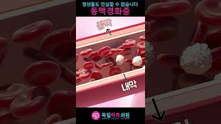 젊은 사람들도 이젠 많이 걸린다는 그 질환